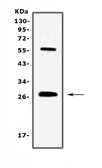 Anti-IL17A antibody used in Western Blot (WB). GTX17587