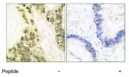 Anti-Thyroid Hormone Receptor alpha antibody used in IHC (Paraffin sections) (IHC-P). GTX17590
