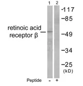 Anti-Retinoic Acid Receptor beta antibody used in Western Blot (WB). GTX17593