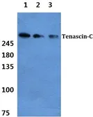 Anti-Tenascin C antibody used in Western Blot (WB). GTX17605
