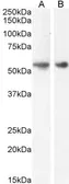 Anti-GLP1R antibody used in Western Blot (WB). GTX17606