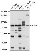 Anti-PDE4B antibody used in Western Blot (WB). GTX17609