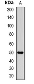 Anti-CD162 antibody used in Western Blot (WB). GTX17665