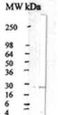 Anti-CNTF antibody used in Western Blot (WB). GTX17692