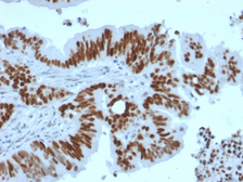 Anti-p53 antibody [TP53/2092R] used in IHC (Paraffin sections) (IHC-P). GTX17698