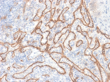 Anti-beta Catenin antibody [CTNNB1/2030R] used in IHC (Paraffin sections) (IHC-P). GTX17706