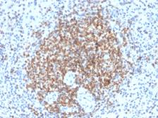 Anti-Bcl-2 antibody [BCL2/2210R] used in IHC (Paraffin sections) (IHC-P). GTX17713