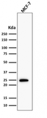 Anti-Bcl-2 antibody [BCL2/1878R] used in Western Blot (WB). GTX17715