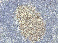 Anti-BCL6 antibody [BCL6/1951R] used in IHC (Paraffin sections) (IHC-P). GTX17716