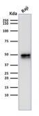 Anti-CD79a antibody [IGA/1790R] used in Western Blot (WB). GTX17720