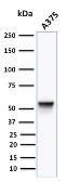 Anti-Vimentin antibody [VM452] used in Western Blot (WB). GTX17723