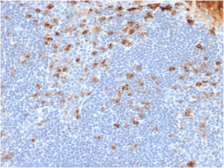 Mouse Anti-Human kappa light chain antibody [rL1C1]. GTX17725