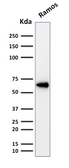 Anti-OCT2 antibody [OCT2/2137] used in Western Blot (WB). GTX17727