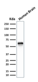 Anti-GPN1 antibody [GPN1/2350] used in Western Blot (WB). GTX17730