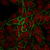 Anti-beta Catenin antibody [rCTNNB1/2173] used in Immunocytochemistry/ Immunofluorescence (ICC/IF). GTX17731