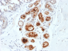 Anti-Mammaglobin A antibody [MGB1/2000] used in IHC (Paraffin sections) (IHC-P). GTX17743