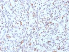 Anti-MyoD1 antibody [rMYD712] used in IHC (Paraffin sections) (IHC-P). GTX17751