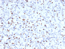 Anti-Myogenin antibody [MYOG/2660] used in IHC (Paraffin sections) (IHC-P). GTX17752