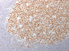 Anti-BCL6 antibody [BCL6/1982] used in IHC (Paraffin sections) (IHC-P). GTX17764