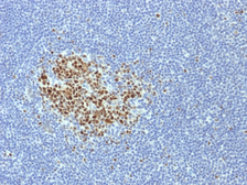 Anti-BCL6 antibody [BCL6/1718] used in IHC (Paraffin sections) (IHC-P). GTX17770