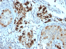 Anti-StAR antibody [STAR/2154] used in IHC (Paraffin sections) (IHC-P). GTX17814