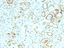 Anti-STAT6 antibody [STAT6/2410] used in IHC (Paraffin sections) (IHC-P). GTX17816