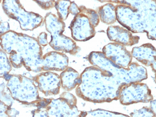 Anti-TIMP2 antibody [TIMP2/2044] used in IHC (Paraffin sections) (IHC-P). GTX17817