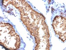 Anti-Vinculin antibody [VCL/2572] used in IHC (Paraffin sections) (IHC-P). GTX17827