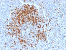Anti-TCL1A antibody [TCL1/2078] used in IHC (Paraffin sections) (IHC-P). GTX17841