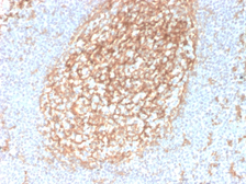 Anti-CD14 antibody [LPSR/2385] used in IHC (Paraffin sections) (IHC-P). GTX17867