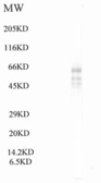 Anti-WDR9.3 antibody used in Western Blot (WB). GTX17907
