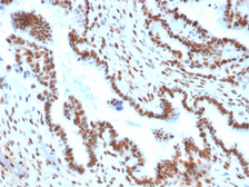 Anti-TLE1 antibody [TLE1/2051] used in IHC (Paraffin sections) (IHC-P). GTX17920