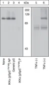 Anti-IKK alpha (phospho Ser176/Ser180) antibody used in Western Blot (WB). GTX17943