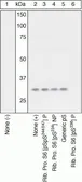 Anti-RPS6 (phospho Ser236) antibody used in Western Blot (WB). GTX17944
