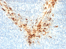 Anti-Mesothelin antibody [MSLN/2131] used in IHC (Paraffin sections) (IHC-P). GTX17953