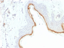 Anti-Filaggrin antibody [FLG/1945] used in IHC (Paraffin sections) (IHC-P). GTX17964