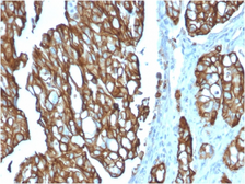 Anti-TACSTD2 antibody [TACSTD2/2151] used in IHC (Paraffin sections) (IHC-P). GTX17970