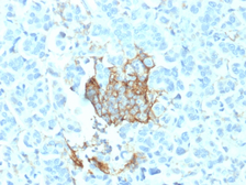 Anti-p75 NGF Receptor / CD271 antibody [NGFR/1964] used in IHC (Paraffin sections) (IHC-P). GTX17979