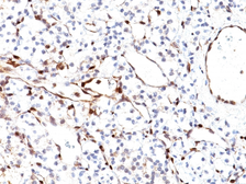 Anti-PTEN antibody [PTEN/2110] used in IHC (Paraffin sections) (IHC-P). GTX17980