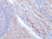 Anti-GluT1 antibody [GLUT1/2476] used in IHC (Paraffin sections) (IHC-P). GTX17991