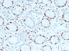Anti-SOX4 antibody [SOX4/2540] used in IHC (Paraffin sections) (IHC-P). GTX17992