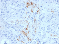 Anti-StAR antibody [STAR/2140] used in IHC (Paraffin sections) (IHC-P). GTX18017