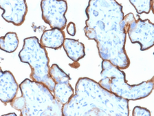 Anti-CD71 antibody [TFRC/1839] used in IHC (Paraffin sections) (IHC-P). GTX18020