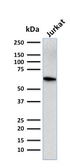 Anti-CD5 antibody [CD5/2416] used in Western Blot (WB). GTX18024