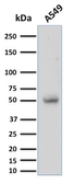 Anti-CD14 antibody [LPSR/2397] used in Western Blot (WB). GTX18025
