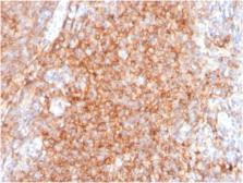 Anti-CD40 antibody [C40/2383] used in IHC (Paraffin sections) (IHC-P). GTX18028