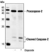 Anti-Caspase 2 antibody [4i13(C2)] used in Western Blot (WB). GTX18029