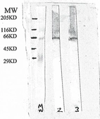 Anti-Presenilin 2 antibody used in Western Blot (WB). GTX18041