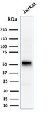 Anti-Cyclin E1 antibody [CCNE1/2460] used in Western Blot (WB). GTX18047