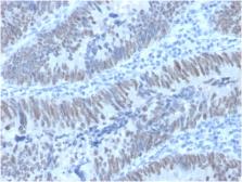 Anti-CDX2 antibody [PCRP-CDX2-1A3] used in IHC (Paraffin sections) (IHC-P). GTX18049